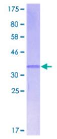 SDS-PAGE (CXCL13-2161H).jpg